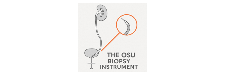 OSU